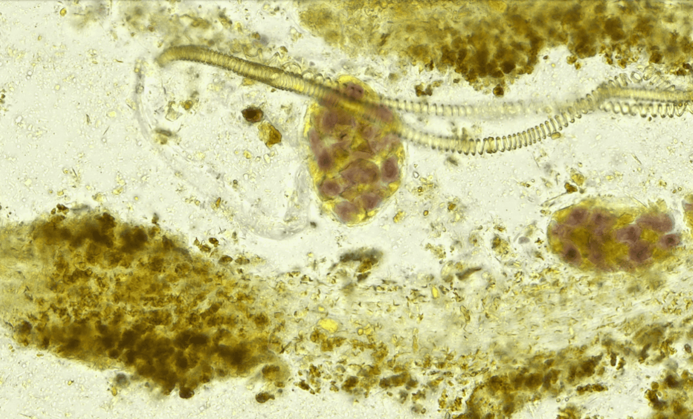 Human fecal trichrome Image