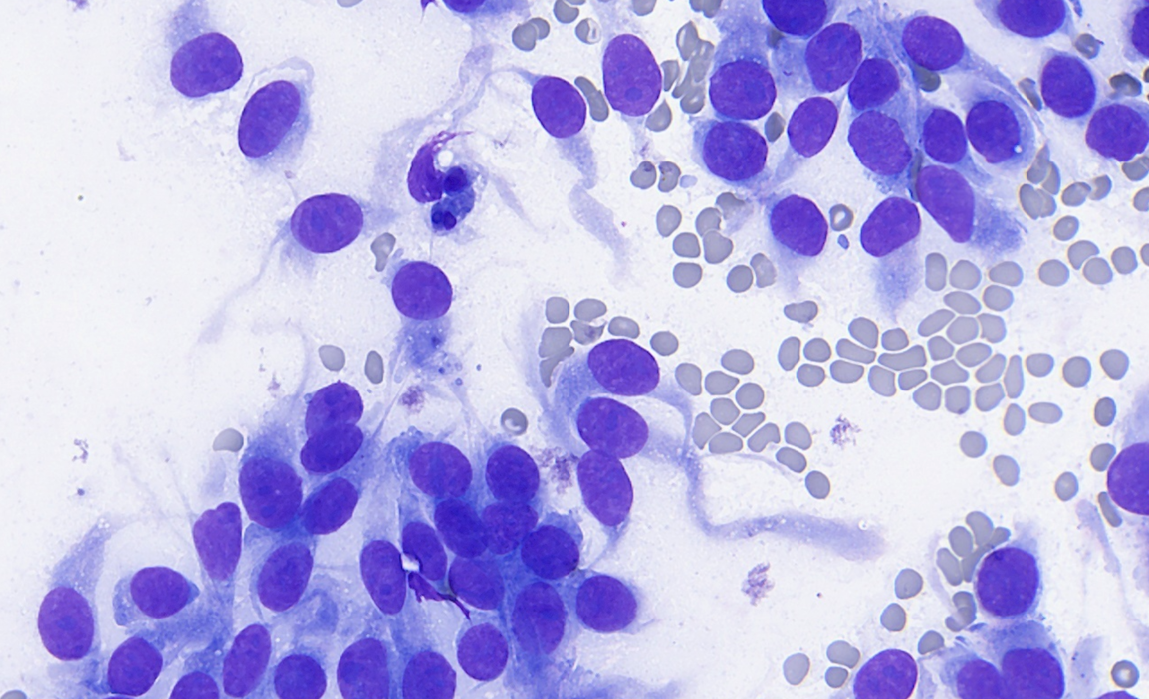 Cytology conventional smear Image