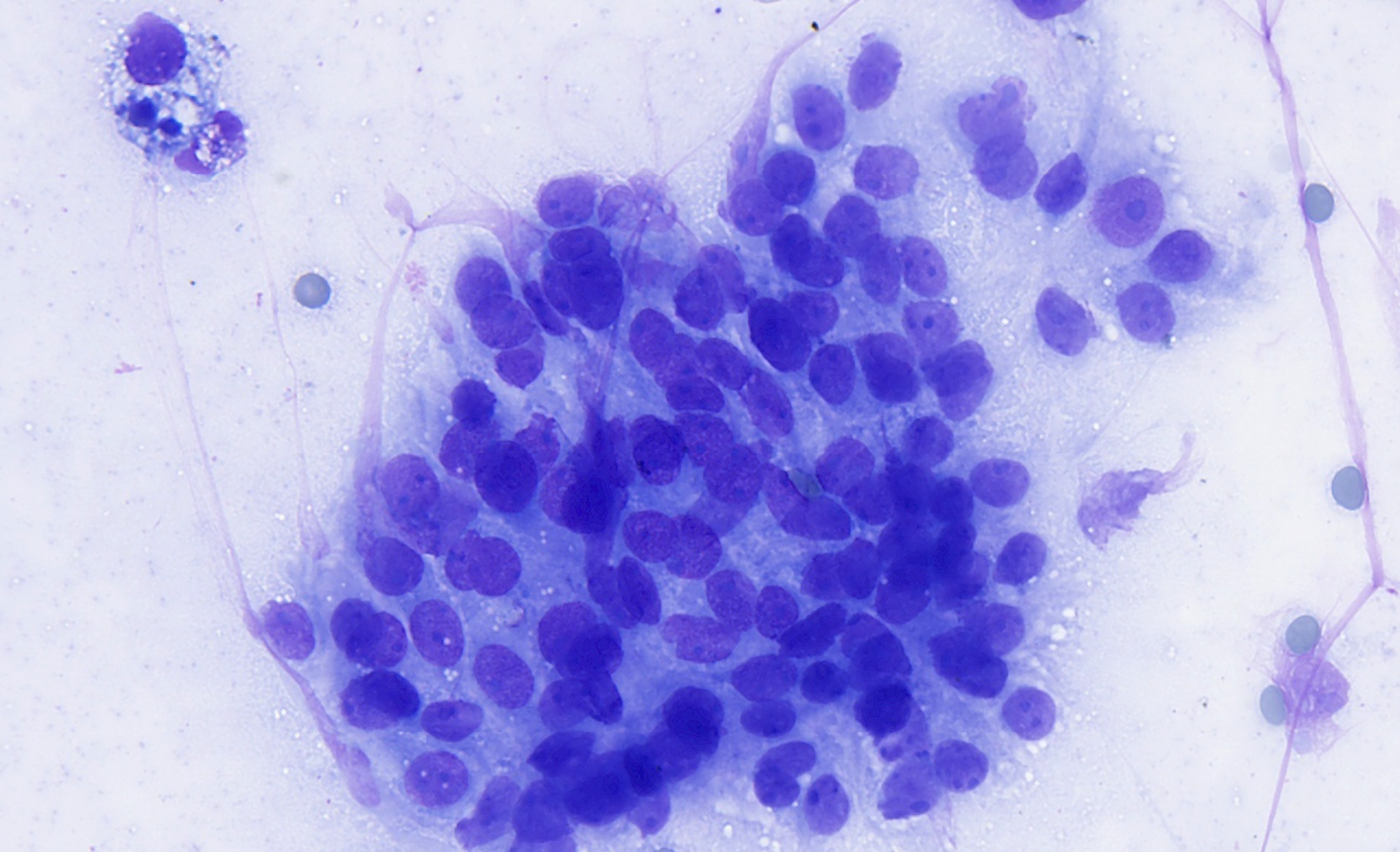 Cytology conventional smear Image