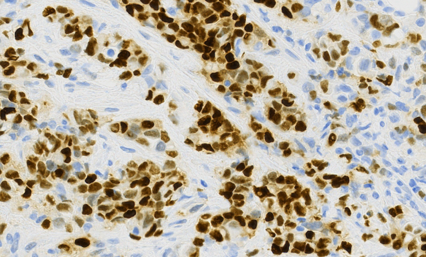 IHC Image