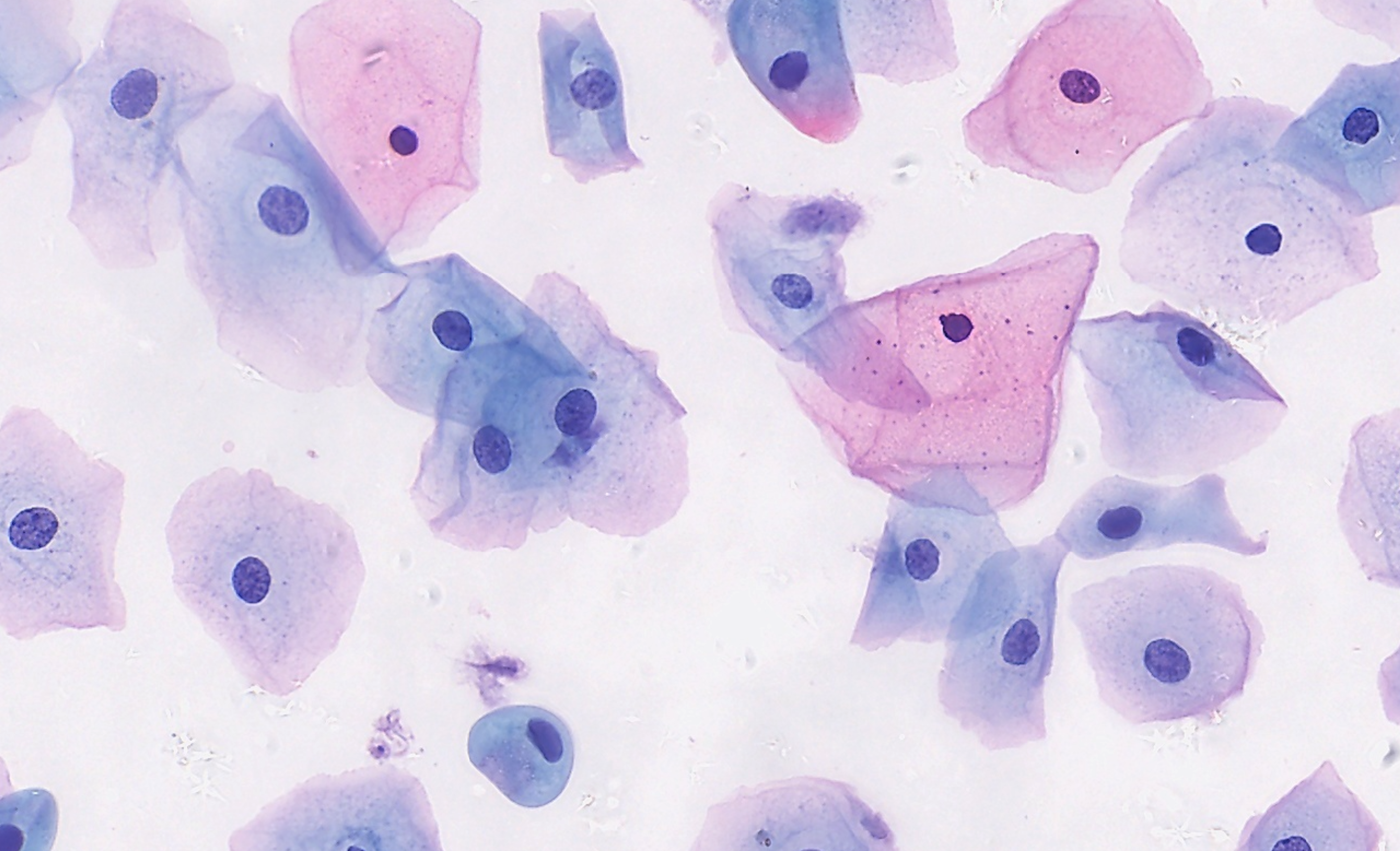 Liquid based Cytology (LBC) Image